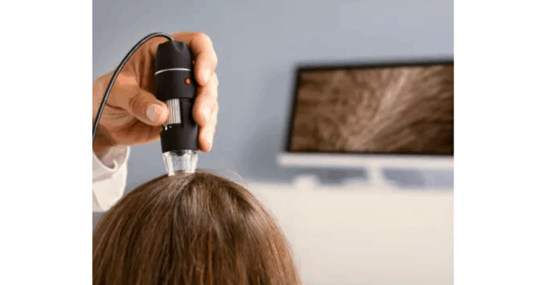 Best Hair Loss Treatment Toronto: A Complete Guide to Restoring Confidence and Healthy Hair